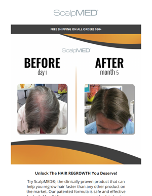 Unlock The HAIR REGROWTH You Deserve!