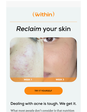 Reclaim Your Skin